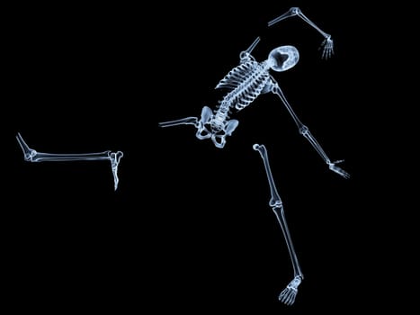 X rayed skeleton that is broken and shattered.