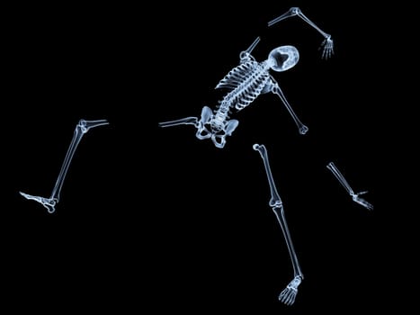 X rayed skeleton that is broken and shattered.