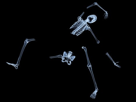 X rayed skeleton that is broken and shattered.