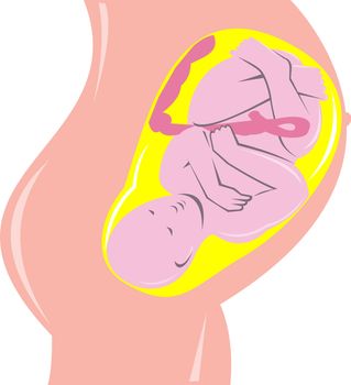 illustration on the development of the human fetus inside womb done in retro woodcut style.