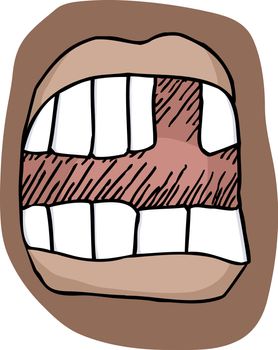 Close-up illustration of an open mouth with a missing tooth