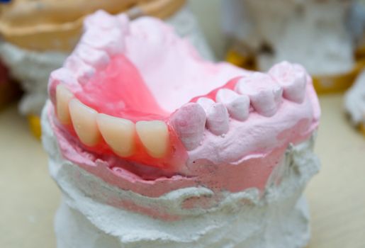 Dental background: work in clinic (operation, tooth replacement)
