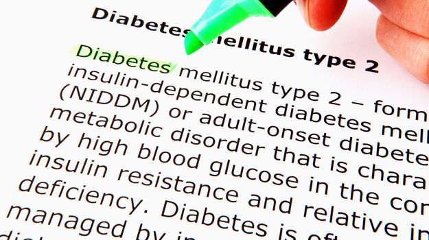 Diabetes mellitus type 2