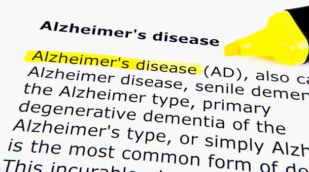 Alzheimer's disease