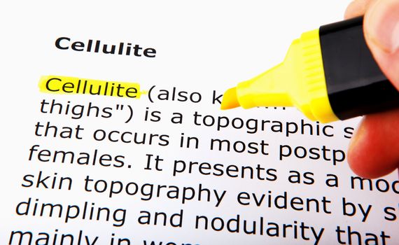 Cellulite