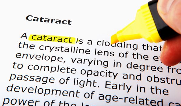 Cataract