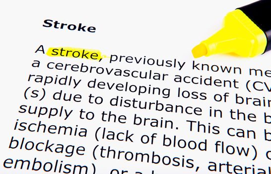 Stroke