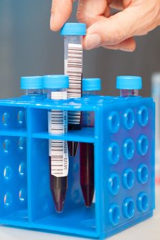 Blood In tube for laboratory analysis
