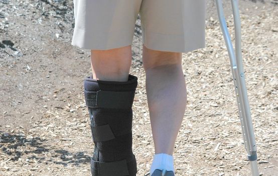 Female with a broken leg walking on crutches.