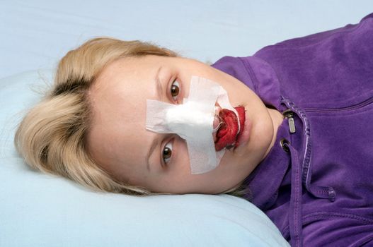 Girl in a blood-stained bandage after operation on a nose.