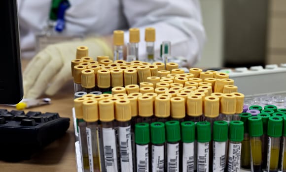 Close-up of blood sample tubes in holder, placed on desk