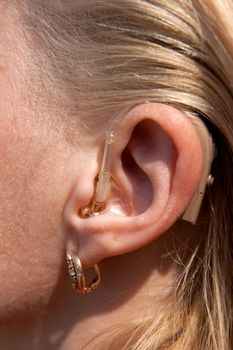 digital hearing aids on young woman ear