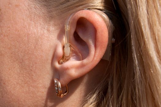 digital hearing aids on young woman ear