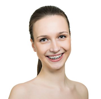 Beautiful young woman with brackets on teeth close up