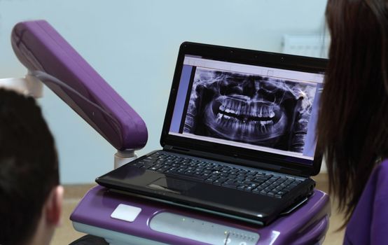 Image of a dentist and her patient looking to a X-ray on a laptop in the dentist office.