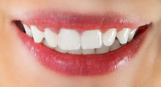 White healthy teeth of smiling woman