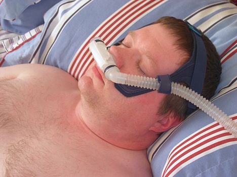 Head and shoulders shot of a slightly overweight man lying on his back in bed, asleep. He is wearing a nasal pillows style CPAP facemask. CPAP (Continuous Positive Airway Pressure) is a common treatment used to prevent sleep apnea, involving a machine which pumps air at a predetermined rate to some sort of facemask.