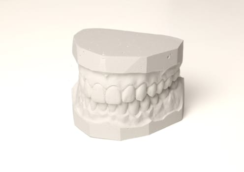A plaster cast in blue tone of a set of teeth. All isolated on white background.