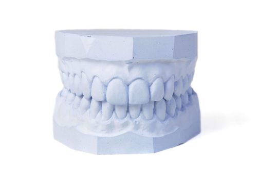 A plaster cast in blue tone of a set of teeth. All isolated on white background.