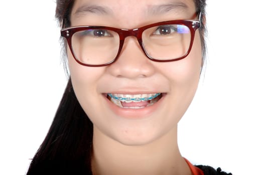 portrait of asian young girl with glasses and braces isolated on white background