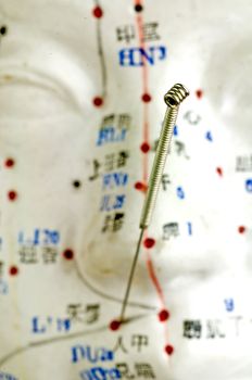 Acupuncture needles on head model