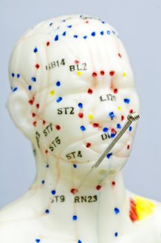 acupuncture demonstration on model