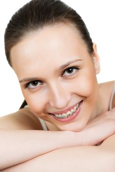 Closeup portrait young woman with brackets on teeth