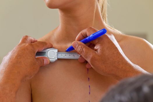 Doctor hands drawing correction lines on young woman's body