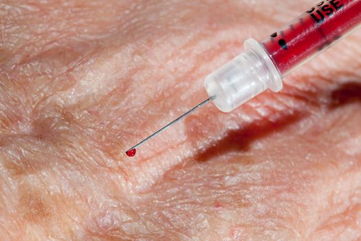 Injection into vein of senior man hand from small hypodermic needle