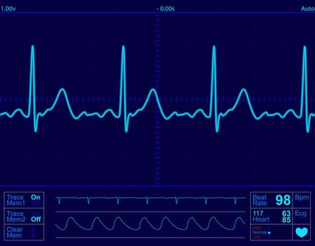 heart monitor screen with normal beat signal