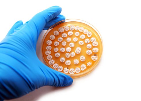 microbiological plate with fungi on white background