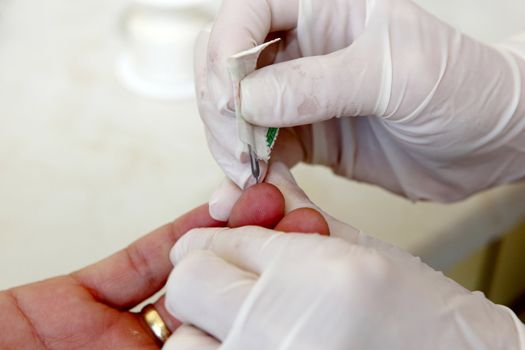 Blood Test