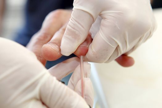 Blood Test
