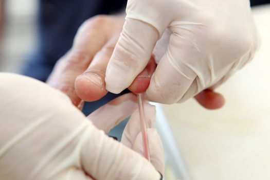 Blood Test