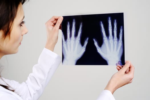 An image of a doctor examing x-ray