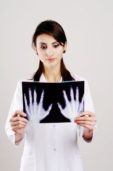 An image of female doctor holding x-ray