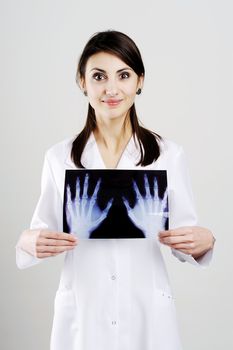 An image of a doctor examing x-ray