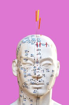 Acupuncture head model