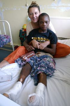 Beira,Mozambique-January 10,2010:Swiss woman,Barbara Hofmann,in hospital with a child function in the legs after being burnt.Since 1989 Barbara after seeing the reality of war,contains in its structure in Beira,children affected by war,orphaned and abandoned.