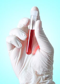 Hand holding a blood sample for analysis