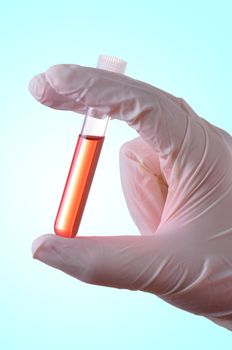 Hand holding a blood sample for analysis