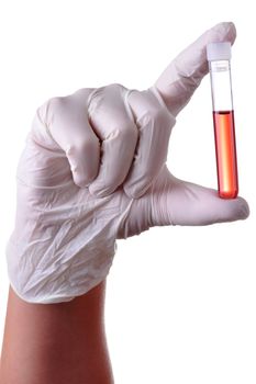 Hand holding a blood sample for analysis, isolated.