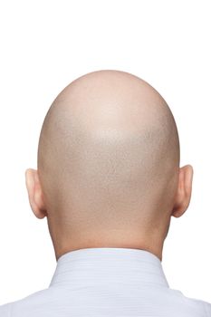 Human alopecia or hair loss - adult man bald head rear or back view