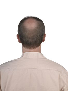 Human hair loss 