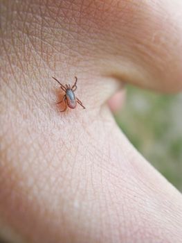 tick, ixodes ricinus, walking on the skin of a human