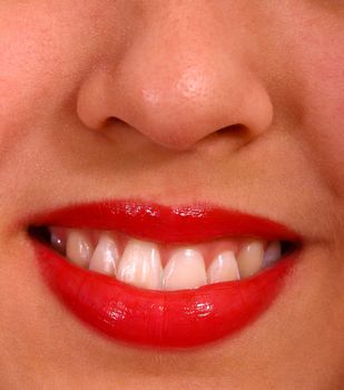 Close Up Of Lips Mouth And Teeth On A Smiling Girl