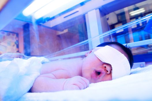 Newborn baby under ultraviolet lamp in the incubator.