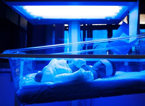 Newborn baby with jaundice under ultraviolet light in the incubator.