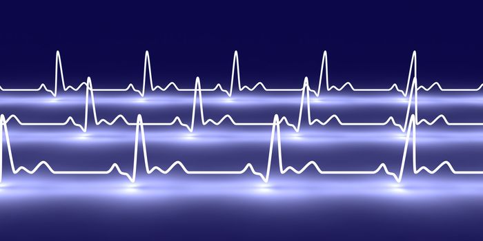 3D rendered Illustration. Heartbeat graph.
