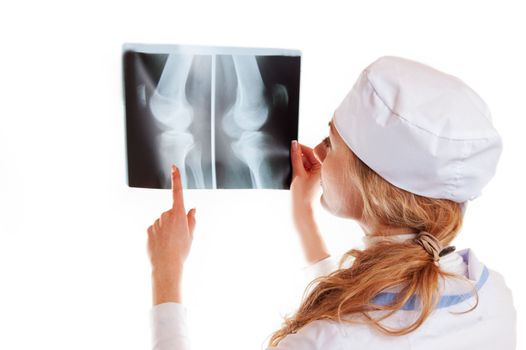 Female doctor holding leg x-ray isolated on white